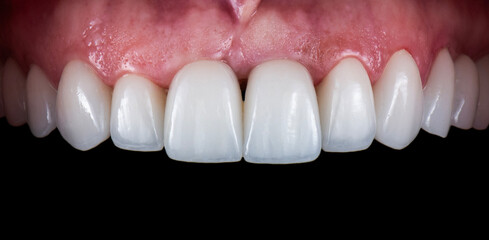 dental treatment pictures