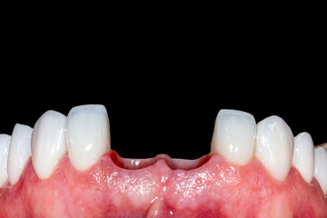 dental treatment pictures