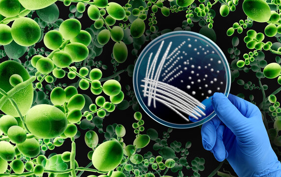 Superbug Fungus microbiology as Deadly Fungal Infection concept as a microbe threat and mucormycosis as Candida auris fungi spreading as a Mycology with a scientist holding a petri dish.
