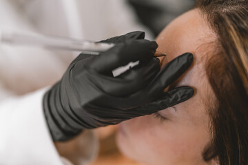 Expertise marking the facial area to inject Botox
