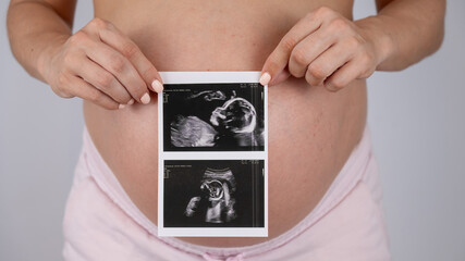 A pregnant woman holds a photo from an ultrasound screening against the background of a bare belly. 