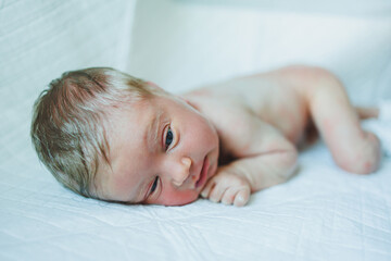 A newborn baby is lying on a diaper with a red rash on his body. Sweating of a newborn child.
