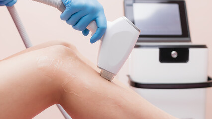 Laser hair removal on legs. Epilation, depilation, body care, removal of unwanted hair, cosmetology. Beautiful female legs. Banner.