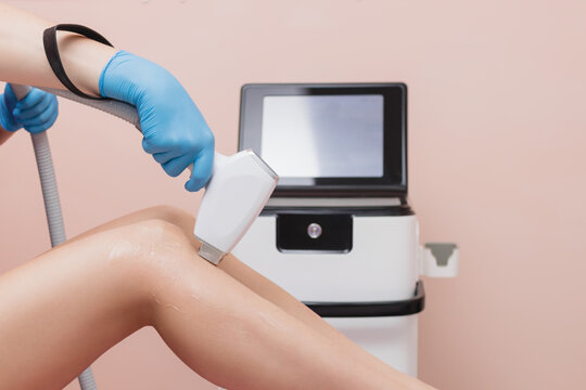 Laser hair removal on legs. Getting rid of unwanted body hair, body care, removal of unwanted hair, cosmetology. Beautiful female legs. Place for text.