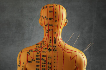 Acupuncture - alternative medicine. Human model with needles in shoulder near dark grey background,...