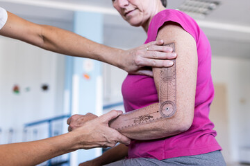 Focused photo of a physiotherapist's hands while measuring the angle of her patient's arm.