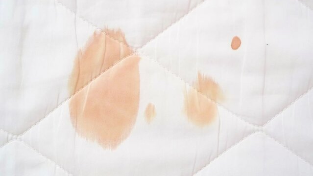 Red blood stains from a woman's menstrual period stain the white mattress cover