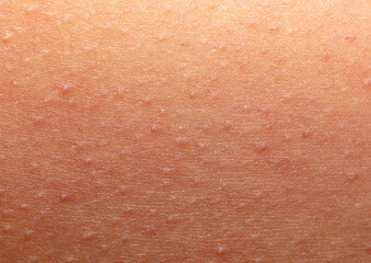 Human skin as an abstract background. Texture