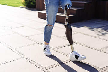 Portrait of young woman with prosthetic leg staying in city. Woman with prosthetic leg. Woman with...