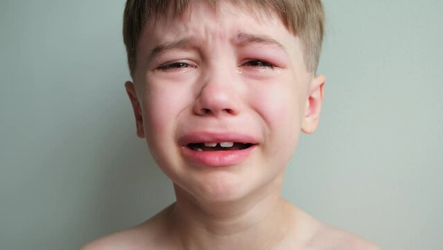 Dramatic portrait of a crying 7 year old boy. Tears flow from the eyes. The upset child. A swollen eye hurts due to a blow or insect bite. Sorrow. Children violence. Stress concept. Kids hysteria. 4K.
