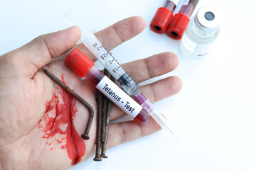 Tetanus test to look for abnormalities from blood