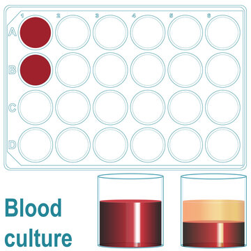 Deep well plate for whole blood culture seen from above and detail of a well with the whole blood sample with and without supernatant