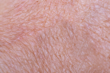 closeup female hand 55 years old with dry skin damage, super macro image, concept care aging skin,...