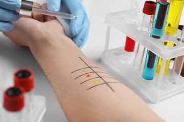 Doctor doing skin allergy test at light table, closeup