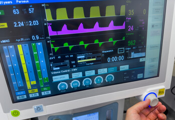 hospital monitor displaying vital signs: heart rate, blood pressure, oxygenation, and end-tidal CO2...