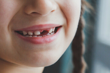 toothless smile of a girl, a baby tooth has fallen out, her face is not visible, anonymous