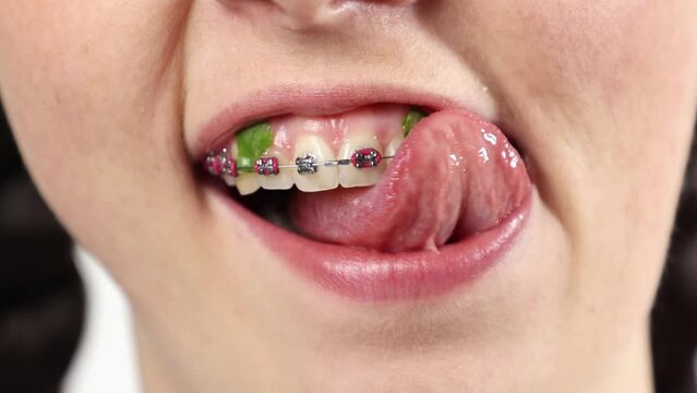 Close-up of young woman showing dirty teeth and funny chewing and cleaning with tongue. Concept of orthodontic treatment and hygiene