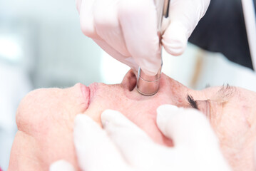 facial cleaning for a major adult woman, with diamond tip, at spa
