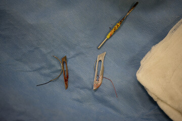 Scalpel and suture thread used in herniated disc surgery