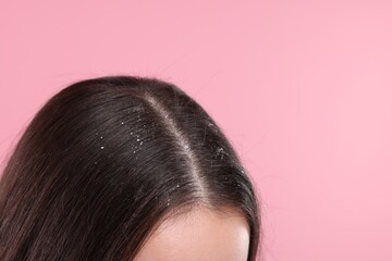 Woman with dandruff problem on pink background, closeup. Space for text