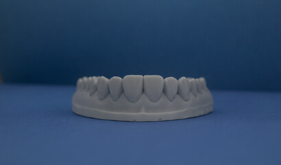 Fototapeta na wymiar Innovation in Dentistry: Detail of 3D Printed Dental Model