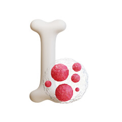 Bone cancer, giant cell tumor of bone, osteosarcoma, 3d icon illustration