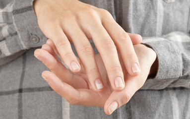 Fingernails with onycholysis after removing gel polish. Womans hands with damaged nails