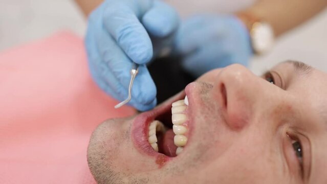 man dentist. Reception at the orthodontist. Polishing. Gel bonding.