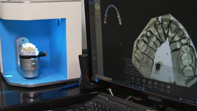 Ceramic dental crowns for implants. Scanning of casts on a 3D scanner for the manufacture of dentures. Fabrication of ceramic dentures in a dental clinic. 