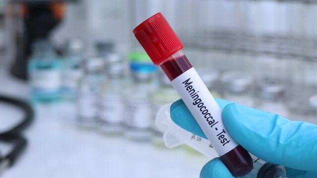 Meningococcal test to look for abnormalities from blood