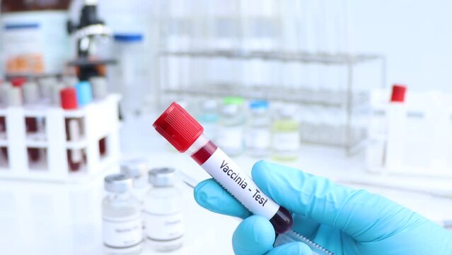 Vaccinia test to look for abnormalities from blood, scientific experiment