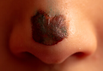 Close-up of a wound on the nose. Macro