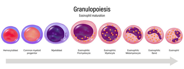 Stages of Granulopoiesis vector. Eosinophil maturation. Hemocytoblast, myeloid progenitor, Myeloblast, Promyelocyte, Myelocyte, Metamylocyte, E.Band and Eosinophil.
