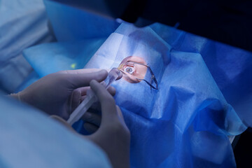 Process laser vision correction, lasik treatment. Doctor use equipment for fixing eyeball, patient...