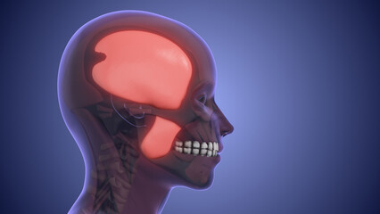 Referred pain from muscle trigger points in the masticatory and neck-shoulder musculature