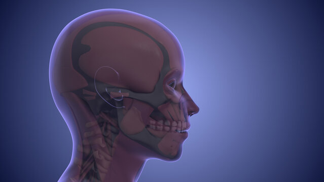 Referred pain from muscle trigger points in the masticatory and neck-shoulder musculature