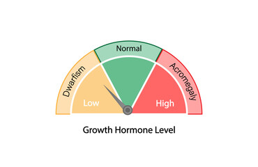 Growth hormone level. Somatotropin. Dwarfism and Acromegaly. Vector illustration.  
 - obrazy, fototapety, plakaty