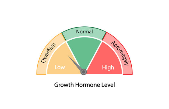 Growth hormone level. Somatotropin. Dwarfism and Acromegaly. Vector illustration.  

