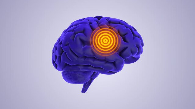 Brain chronic pain medical animation