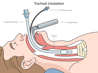 Tracheal intubation structure diagram hand drawn schematic vector illustration. Medical science educational illustration - obrazy, fototapety, plakaty