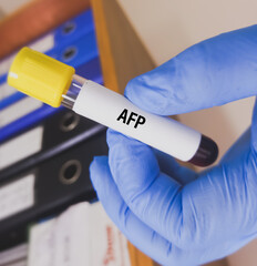 Blood sample for Alpha-fetoprotein (AFP) testing, tumor or cancer marker test for liver.