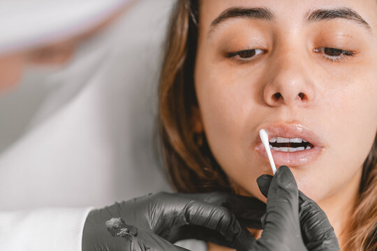 Doctor hydrating the woman's lips after a Botox injection