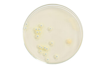 Colony morphology of Yeast and mould. Fungal colony morphology. Fungal growth in DG18. Dichloran Glycerol media. Incubated plates.