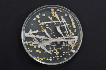 Bacteria. Microbiology. Bacterial colony morphology. Bacterial growth in PCA. Plate Count Agar....
