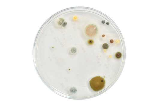 Colony morphology of Yeast and mould. Fungal colony morphology. Fungal growth in DG18. Dichloran Glycerol media. Incubated plates.