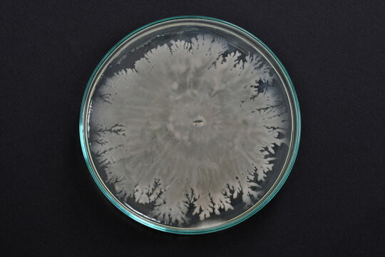 Bacteria. Microbiology. Bacterial colony morphology. Bacterial growth in PCA. Plate Count Agar. Incubated plates. Microbial colonies. Microbial growth. Colony characteristics.