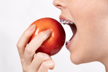 Side view of young woman with braces biting off red apple. White background. Concept of orthodontic...