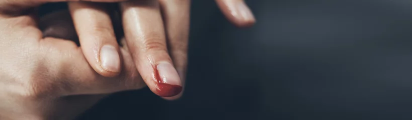 Deurstickers woman bloody finger © ARAMYAN