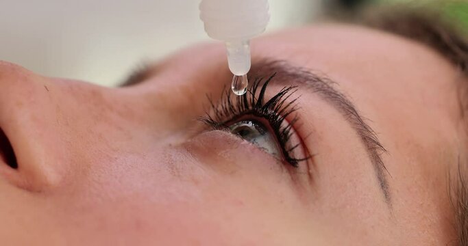 Young woman applies eye drops to dry irritated eyes