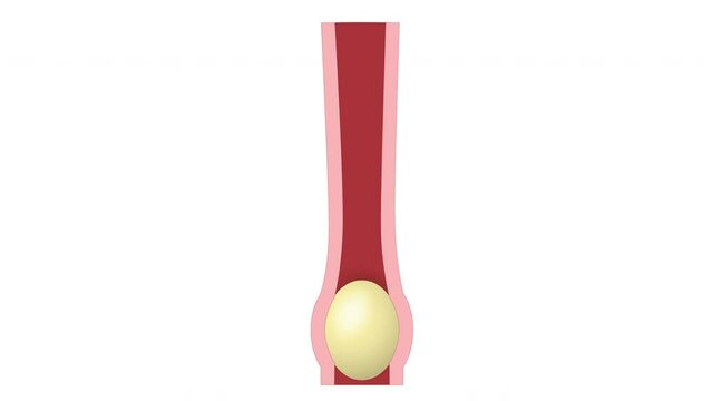 Peristalsis. Gastrointestinal motility. Smooth muscle contraction. 2d animation of peristaltic waves